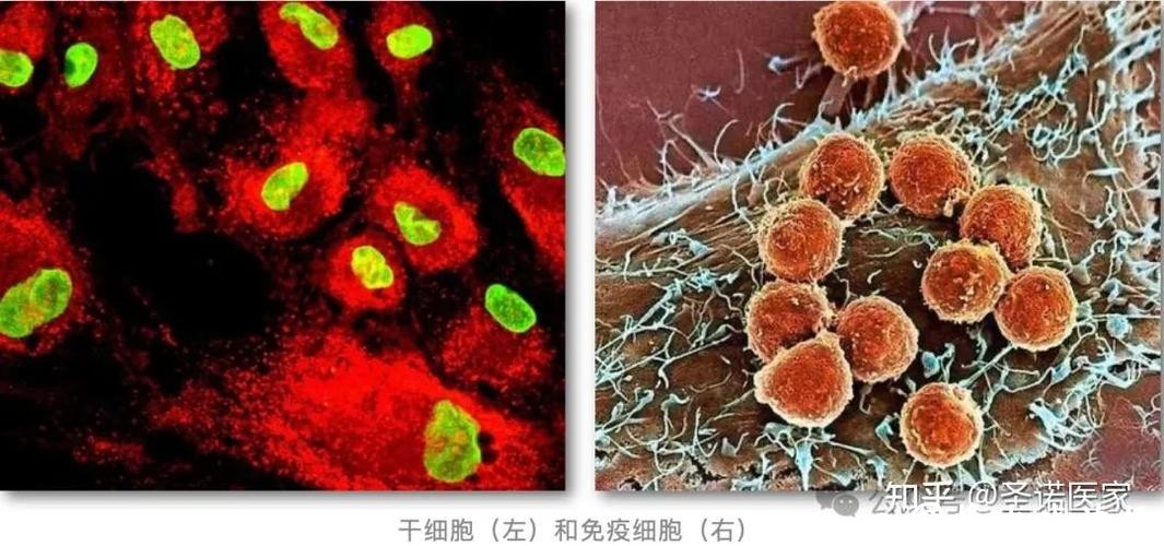 免疫系统为何阻止不了肿瘤转移?这项成果破解谜题,登上《细胞》 免疫系统为何阻止不了肿瘤转移?这项成果破解谜题,登上《细胞》