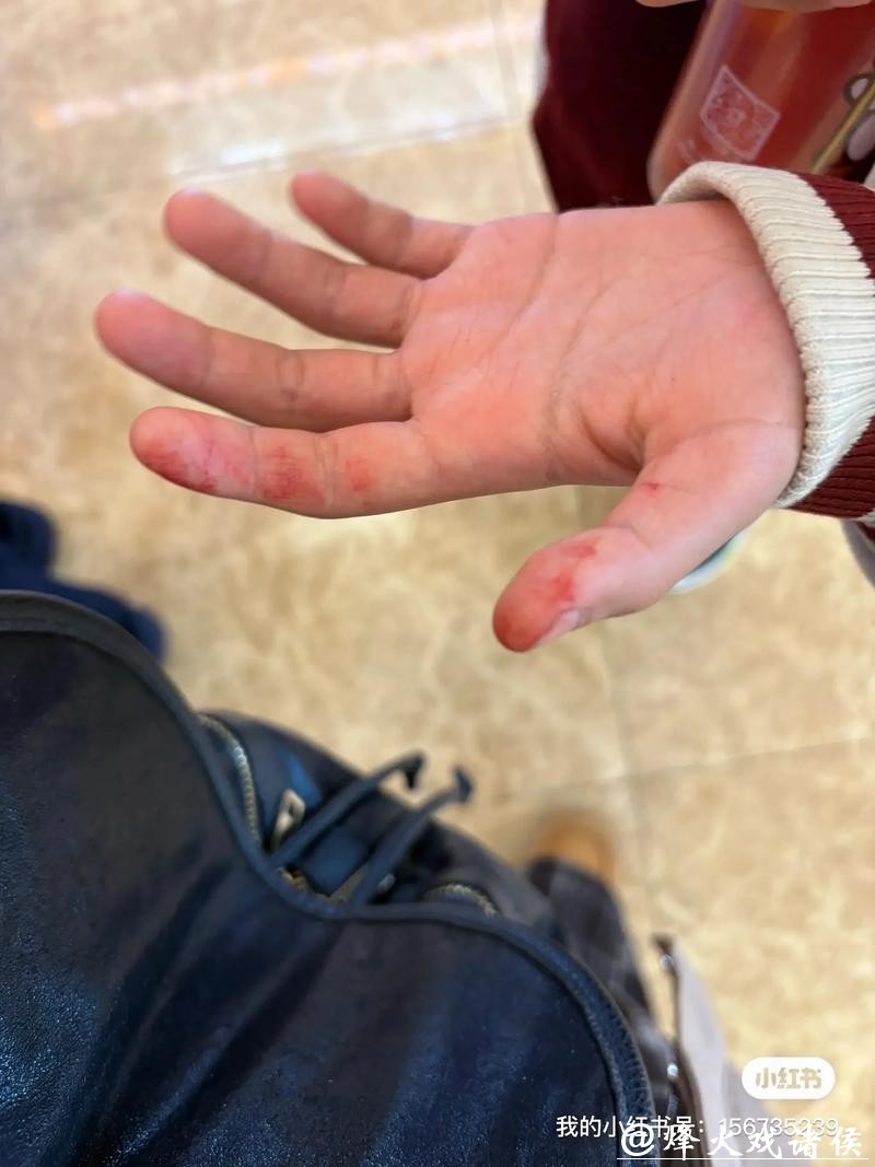 沪上知名儿童游乐机构,两岁宝摔落骨折!后面的事,家长更“心痛” 沪上知名儿童游乐机构,两岁宝摔落骨折!后面的事,家长更“心痛”